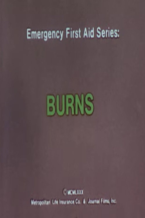Emergency First Aid Series: Burns official trailer poster